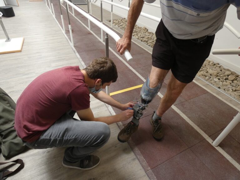 Trinytec designs, builds and sells a range of bespoke prosthetics for patients having undergone amputations (c) Trinytec